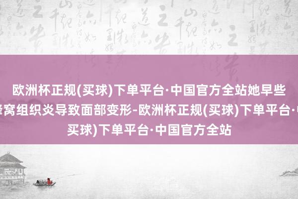 欧洲杯正规(买球)下单平台·中国官方全站她早些年也曾患上蜂窝组织炎导致面部变形-欧洲杯正规(买球)下单平台·中国官方全站